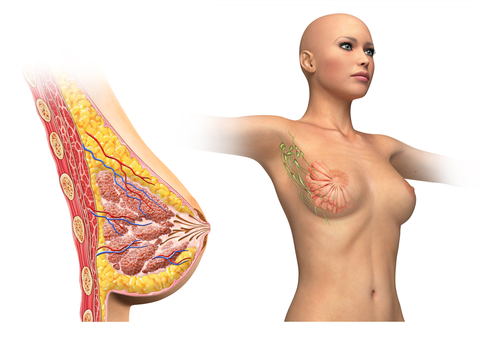 Lymphatic Cells in breast cancer