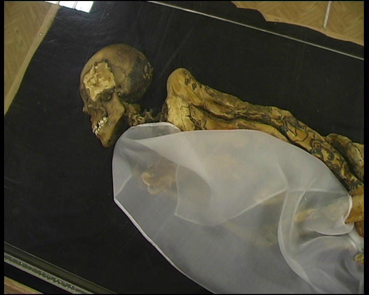 Breast Cancer Found In 2,500-Year-Old Mummified Siberian Princess