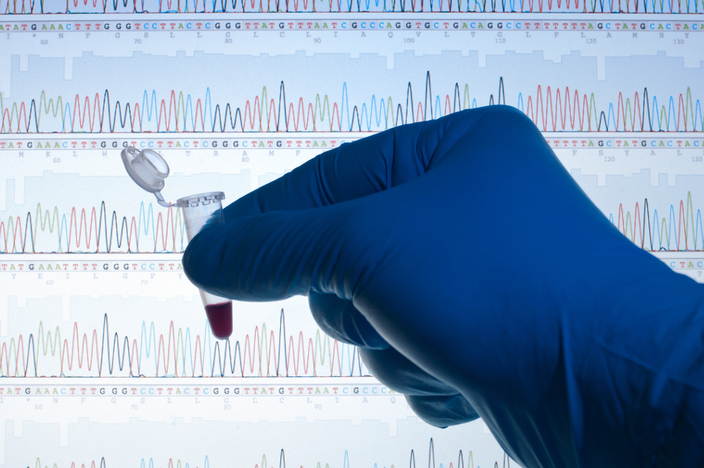 Study Finds Triple-Negative Breast Cancer Patients Benefit From Genetic Screening