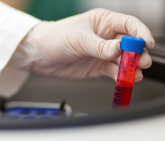 Danish Researchers Develop New Blood Test Able to Predict Future Breast Cancer
