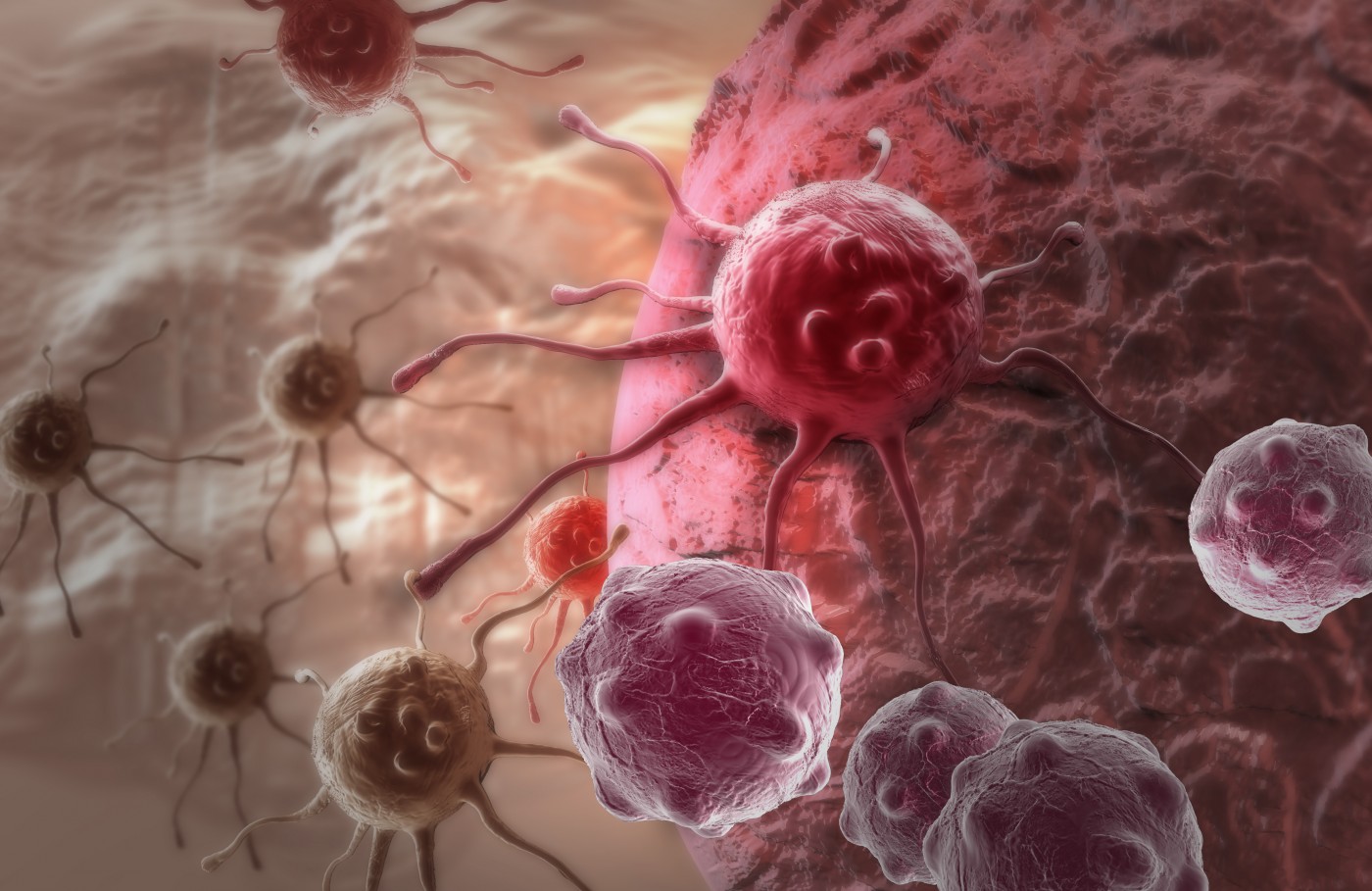 HER2-Positive Breast Cancer Shows Strong Immune Response to Single Dose of Trastuzumab