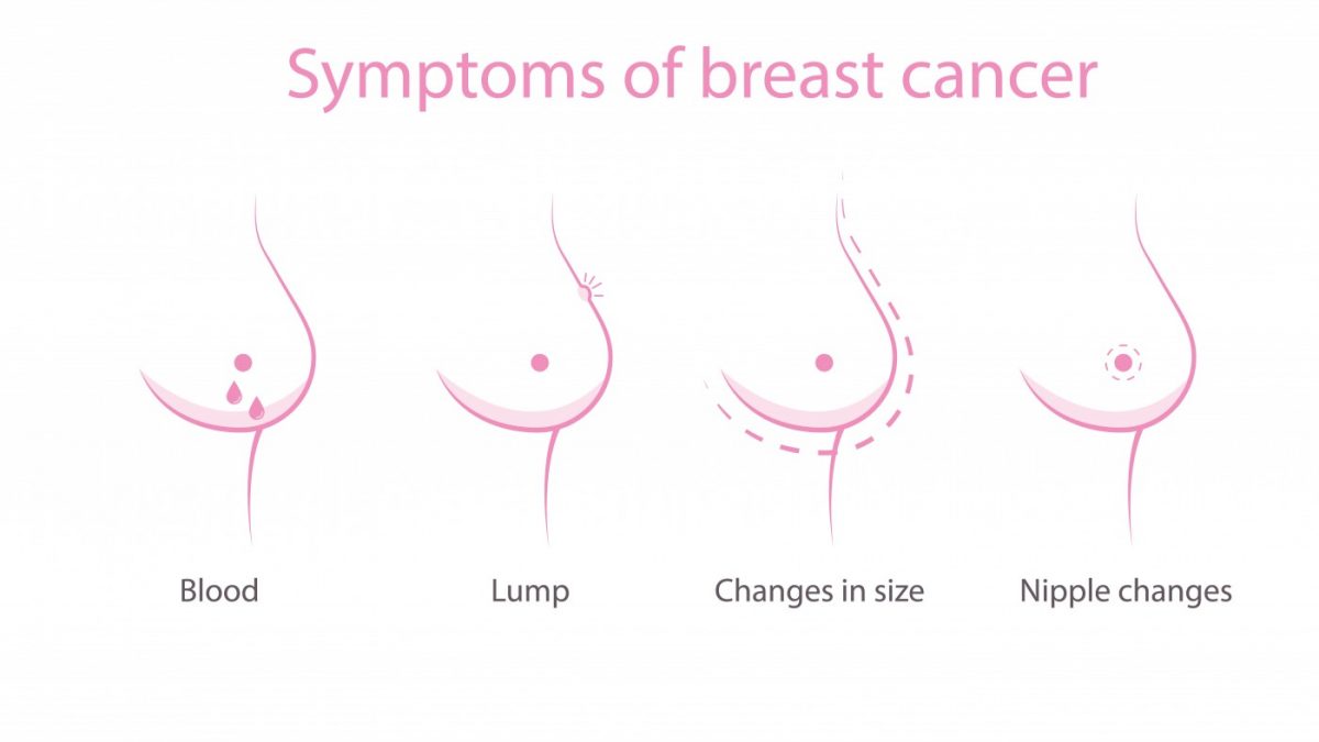 Breast lumps, types of breast lumps