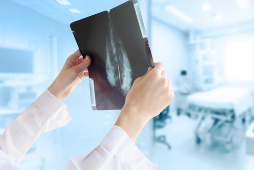radiologists detect breast cancer in split second