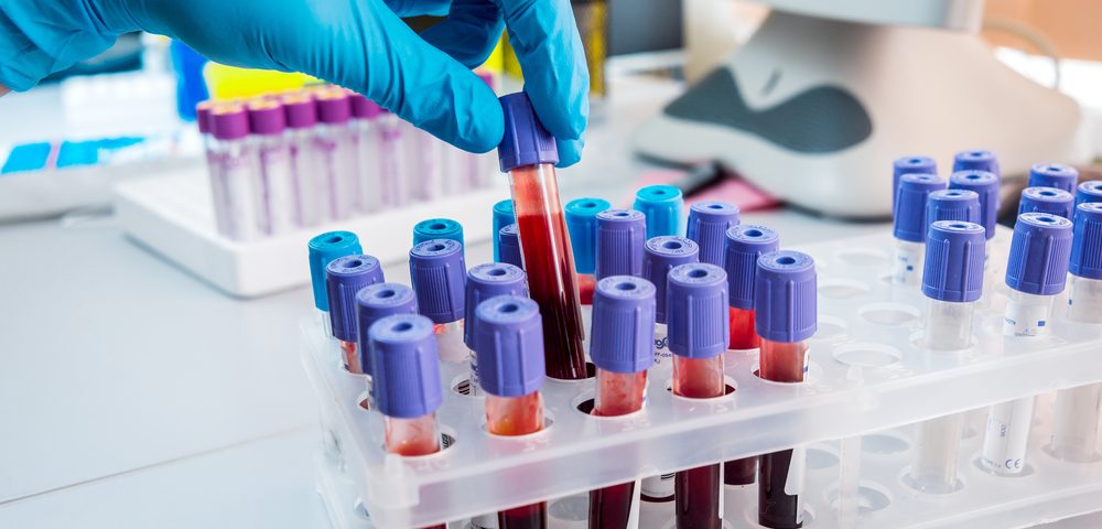 Quick, Less Invasive Blood Test May Detect Breast Cancer Earlier