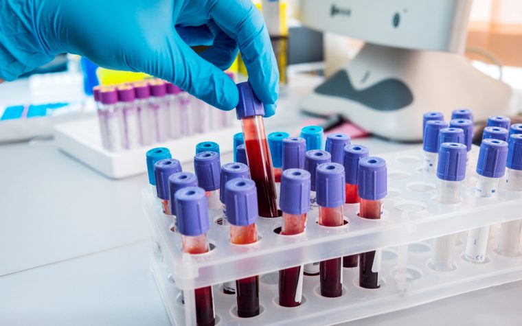 blood test to detect breast cancer