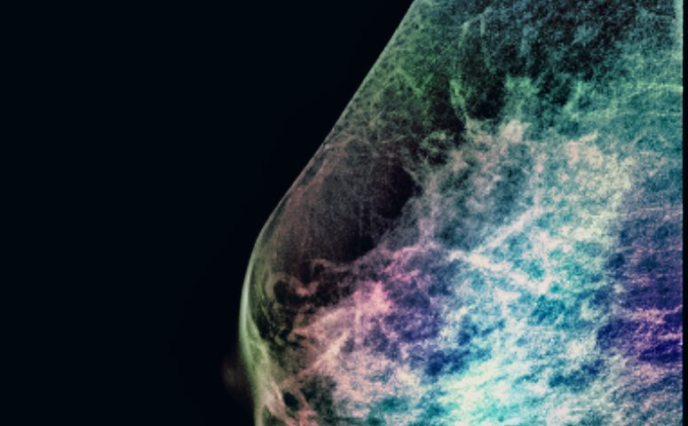 New Technique Can Spot Breast Tumors Other Methods Might Miss