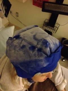 My Husband Froze My Head to Save My Hair