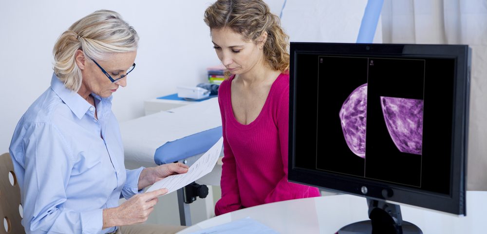 One-Third of Breast Cancer Patients in US Not Given Mammograms in Year After Treatment