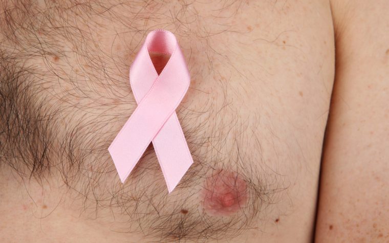 male mammogram