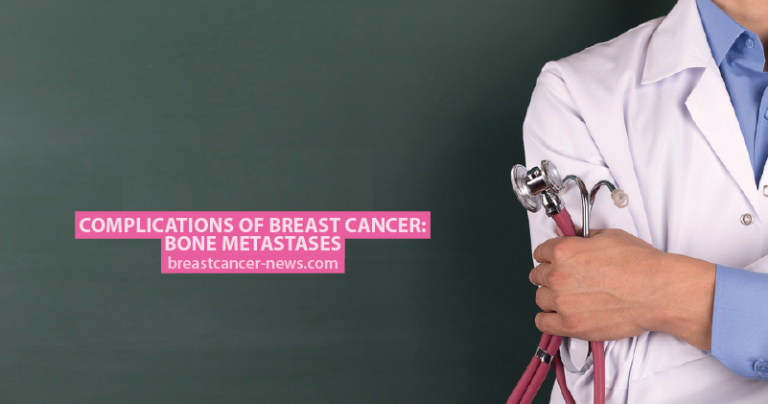 Complications of Breast Cancer: Bone Metastases - Breast Cancer News