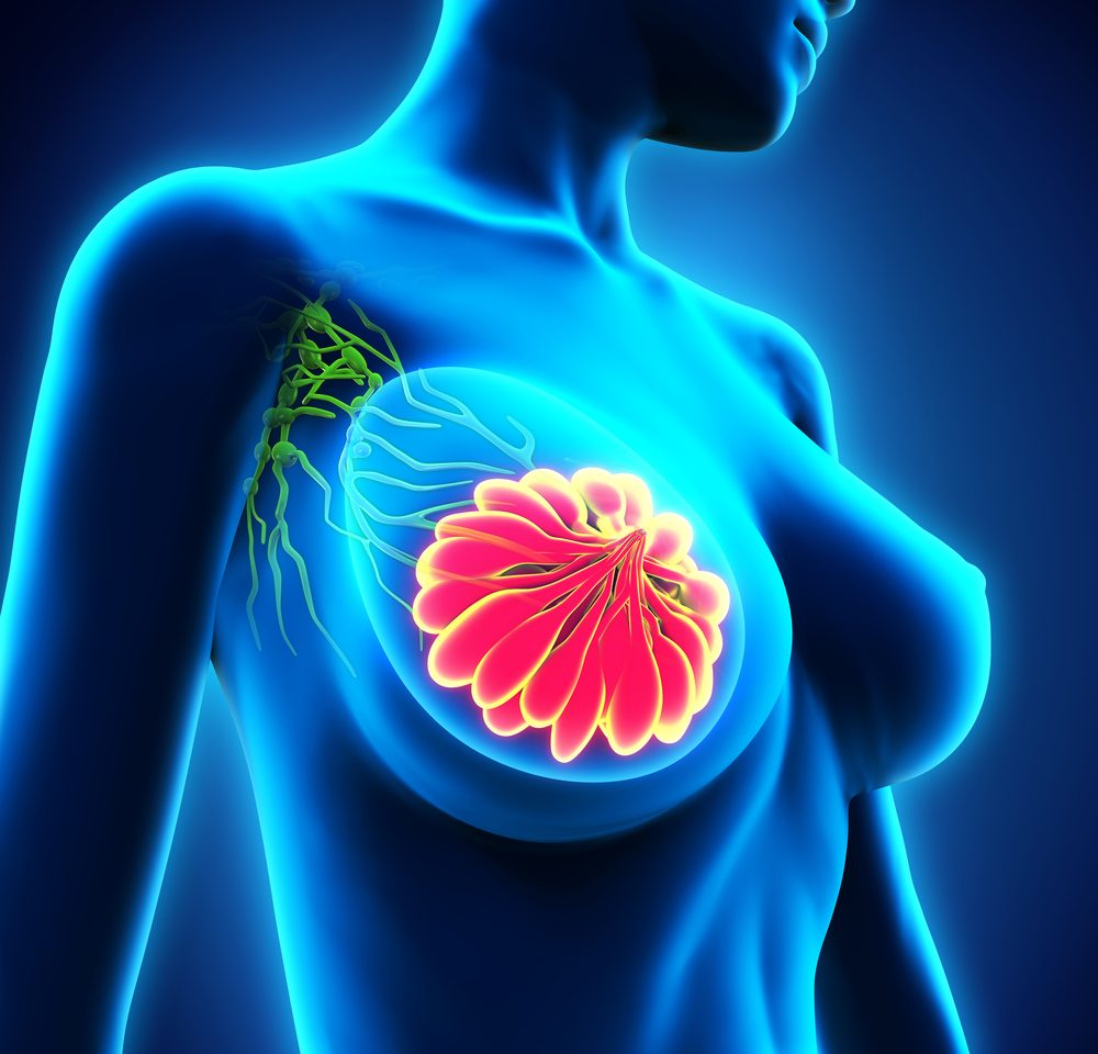 Best Radiation and Breast Reconstruction Chicago