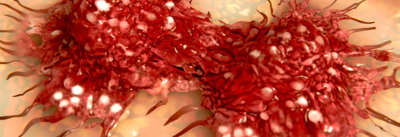 Blocking Interaction Between Blood Vessels, Cancer Cells Could Prevent Disease’s Spread, Study Says