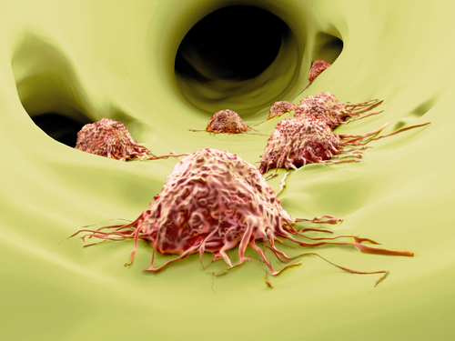 A Primary Breast Cancer Tumor Can Inhibit Cancer Cells from Forming Secondary Tumors, Mice Study Shows