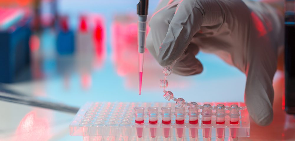 Devyser’s Gene Screening Test for Breast, Ovarian Cancers Approved in Europe Devyser’s Gene Screening Test for Breast, Ovarian Cancers Approved in Europe